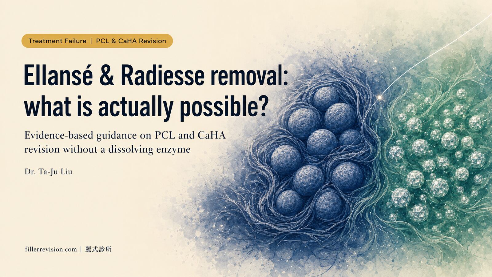 Radiesse vs Ellansé Removal: What Is Actually Possible?